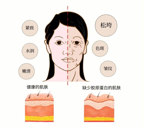 胶原蛋白饮是智商税吗？喝胶原蛋白饮有用吗