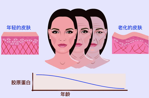 口服胶原蛋白哪个牌子效果好？胶原蛋白怎么选