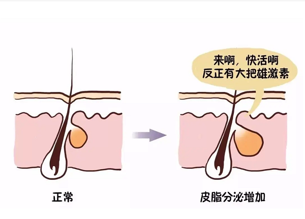 油性皮肤怎么改善？怎么快速摆脱油光满面