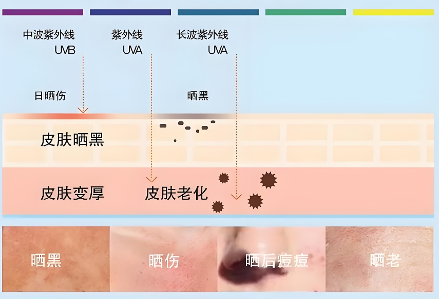 晒后如何补救才不会变黑？晒后还能正常护肤吗