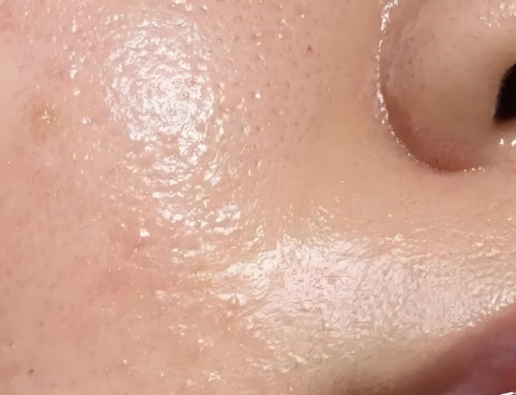夏天脸很容易出油怎么办？磨皮抛光脸怎么养成