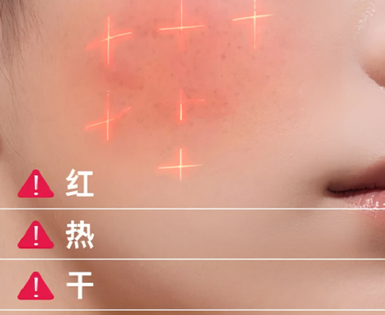 适合春季敏感肌的水乳推荐，告别春敏干燥红痒